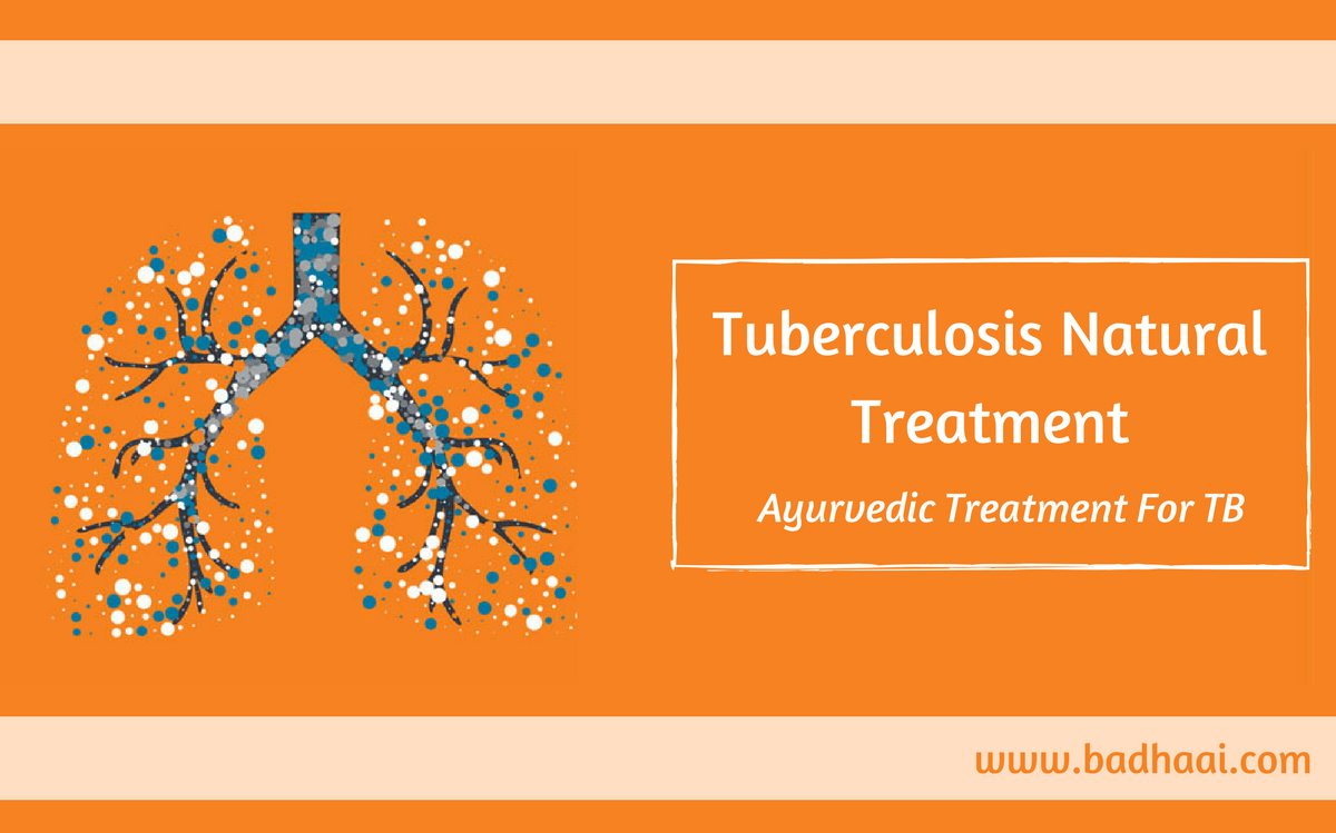 Tuberculosis Natural Treatment Tuberculosis Natural Treatment