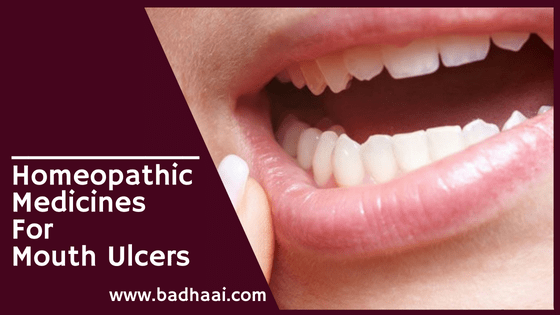 homeopathic medicine for mouth ulcers homeopathic medicine for mouth ulcers