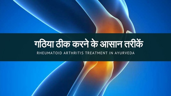 Rheumatoid Arthritis Treatment In Ayurveda in Hindi Rheumatoid Arthritis Treatment In Ayurveda in Hindi